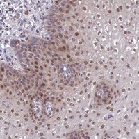 Anti-ANKRD52 antibody produced in rabbit 