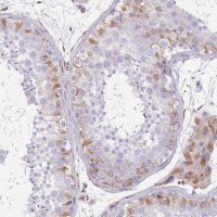 Anti-ANKRD53 antibody produced in rabbit 
