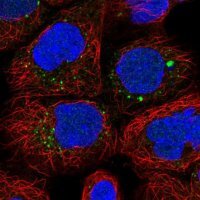Anti-ANKRD6 antibody produced in rabbit 