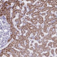 Anti-ANKRD60 antibody produced in rabbit 