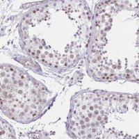 Anti-ANKRD62 antibody produced in rabbit 
