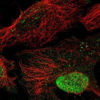 Anti-ANKRD7 antibody produced in rabbit 