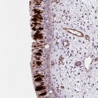 Anti-ANKUB1 antibody produced in rabbit 