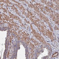 Anti-ANO10 antibody produced in rabbit 