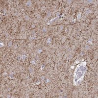 Anti-ANO5 antibody produced in rabbit 