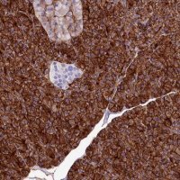 Anti-ANO6 antibody produced in rabbit 