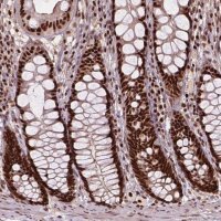 Anti-ANP32A antibody produced in rabbit HPA063133-100UL