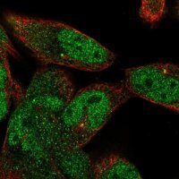 Anti-ANP32A antibody produced in rabbit HPA063133-100UL