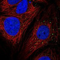 Anti-AP1M2 antibody produced in rabbit 