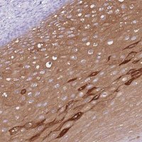 Anti-AP3S2 antibody produced in rabbit 