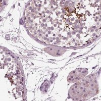Anti-AP4M1 antibody produced in rabbit 