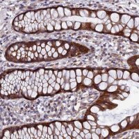 Anti-AP4S1 antibody produced in rabbit 