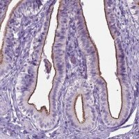 Anti-AP5B1 antibody produced in rabbit 