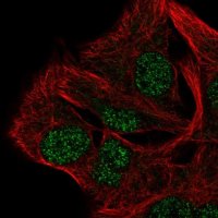 Anti-AP5B1 antibody produced in rabbit