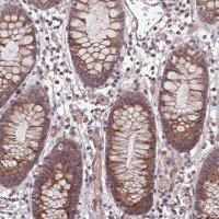 Anti-APBA3 antibody produced in rabbit 