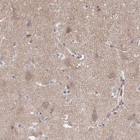 Anti-APBB1 antibody produced in rabbit 