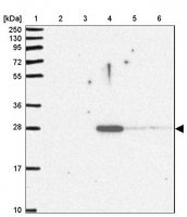 Anti-APCS antibody produced in rabbit HPA053294-100UL