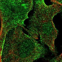 Anti-APMAP antibody produced in rabbit 