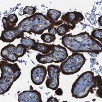 Anti-APMAP antibody produced in rabbit HPA012863-100UL