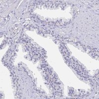 Anti-APOB antibody produced in rabbit 