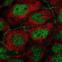 Anti-APOC3 antibody produced in rabbit 