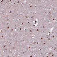 Anti-APTX antibody produced in rabbit 