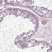 Anti-AREG antibody produced in rabbit 