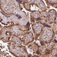 Anti-ARHGAP17 antibody produced in rabbit 