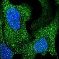 Anti-ARHGAP17 antibody produced in rabbit 