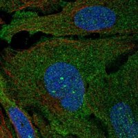Anti-ARHGAP19 antibody produced in rabbit 