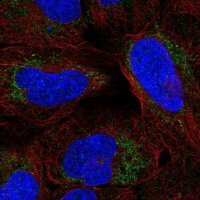 Anti-ARHGAP20 antibody produced in rabbit 