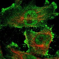Anti-ARHGAP23 antibody produced in rabbit 