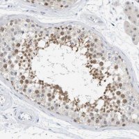Anti-ARHGAP28 antibody produced in rabbit 