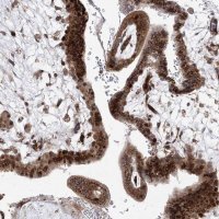 Anti-ARHGAP31 antibody produced in rabbit 