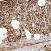 Anti-ARHGAP33 antibody produced in rabbit 
