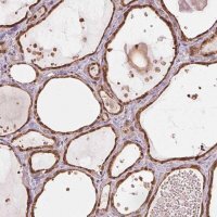 Anti-ARHGAP6 antibody produced in rabbit 