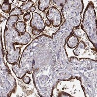 Anti-ARHGAP8 antibody produced in rabbit 
