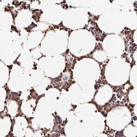 Anti-ARHGDIB antibody produced in rabbit HPA051235-100UL