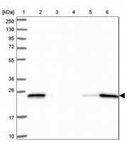 Anti-ARHGDIB antibody produced in rabbit HPA051235-100UL