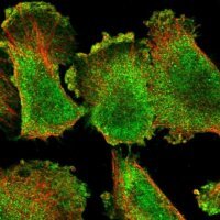Anti-ARHGEF26 antibody produced in rabbit 