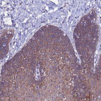 Anti-ARHGEF35 antibody produced in rabbit 