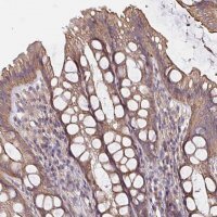Anti-ARHGEF39 antibody produced in rabbit 