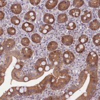 Anti-ARHGEF5 antibody produced in rabbit 