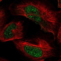 Anti-ARID2 antibody produced in rabbit 