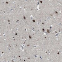 Anti-ARID5B antibody produced in rabbit 