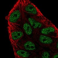 Anti-ARIH2 antibody produced in rabbit 