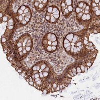 Anti-ARL14EP antibody produced in rabbit 