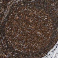 Anti-ARPC2 antibody produced in rabbit 