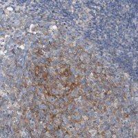 Anti-ARPC5L antibody produced in rabbit 