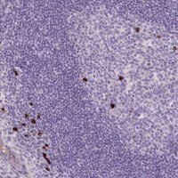 Anti-ARRDC2 antibody produced in rabbit 